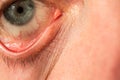 The manÃ¢â¬â¢s eye is gray-blue with red veins on it very close